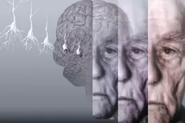Пансионаты для больных Альцгеймера