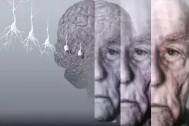 Пансионаты для больных Альцгеймера