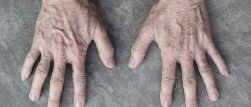 Сосуды и уход за ними в пожилом возрасте