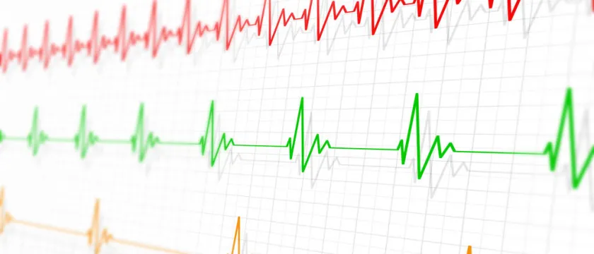 Брадикардия: как повысить пульс у пожилых людей