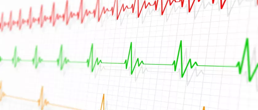 Брадикардія: як підвищити пульс у людей похилого віку