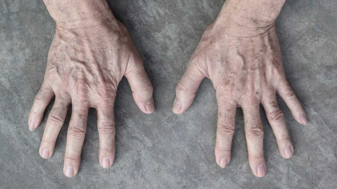 Судини та догляд за ними в похилому віці