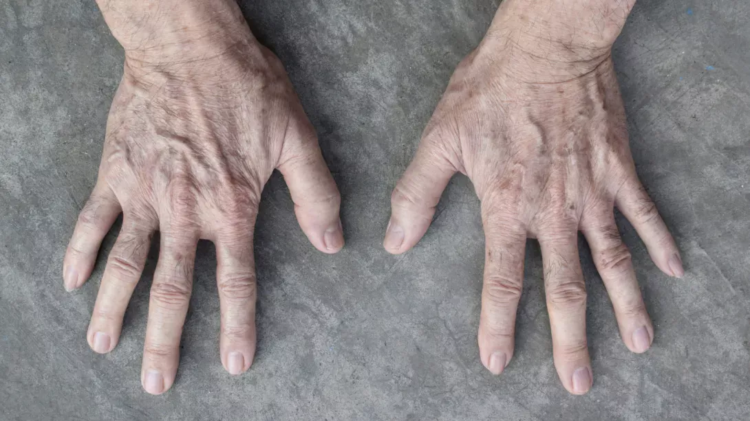 Сосуды и уход за ними в пожилом возрасте