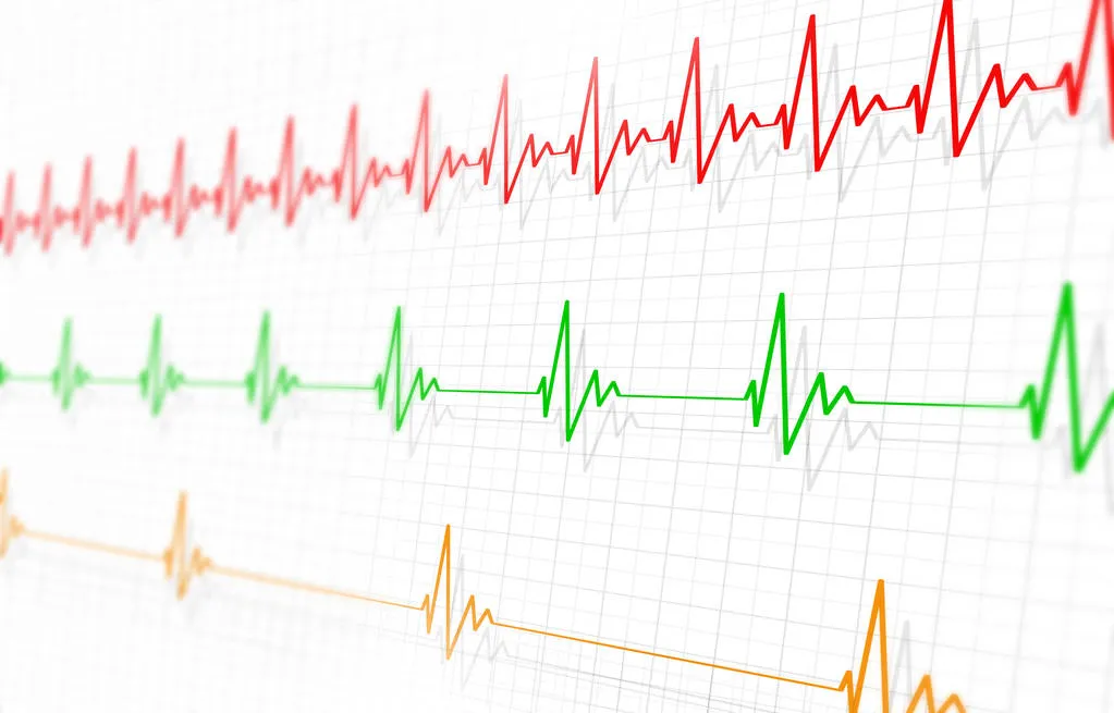 Брадикардия: как повысить пульс у пожилых людей