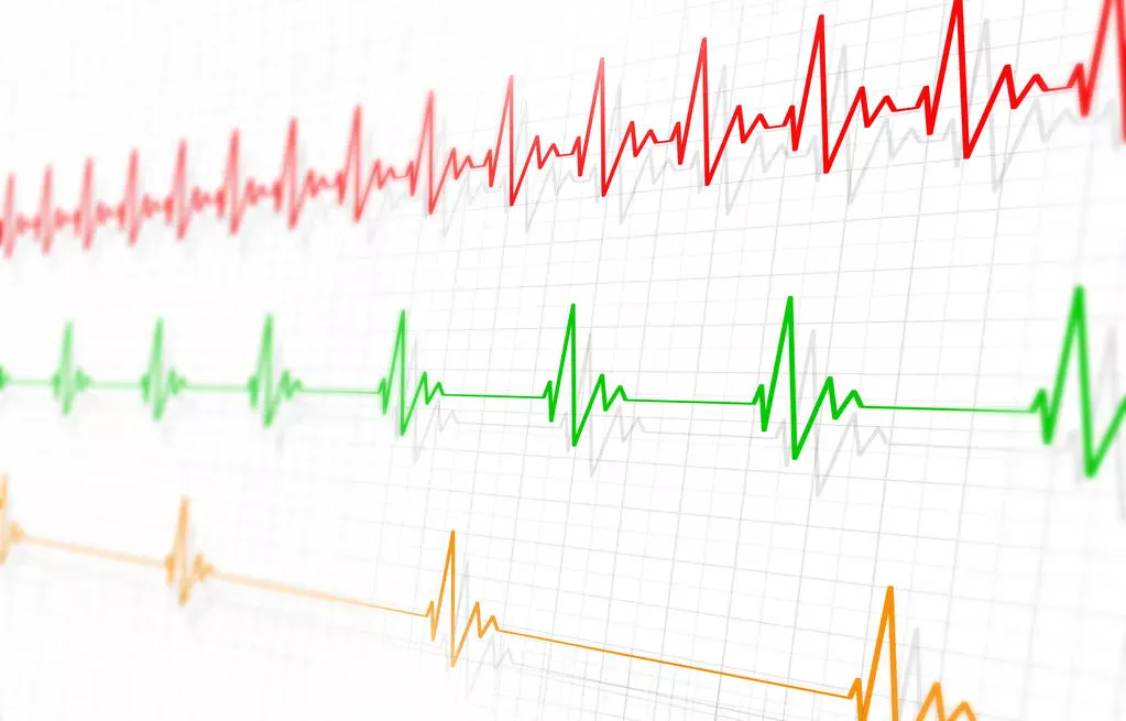 Брадикардія: як підвищити пульс у людей похилого віку