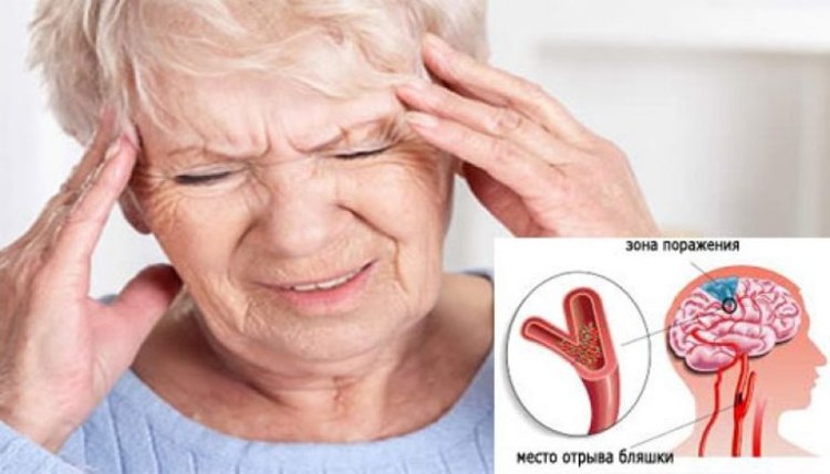 Востановление клеток головного мозга