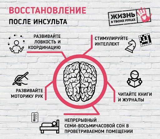 Реабилитация после инсульта Киев